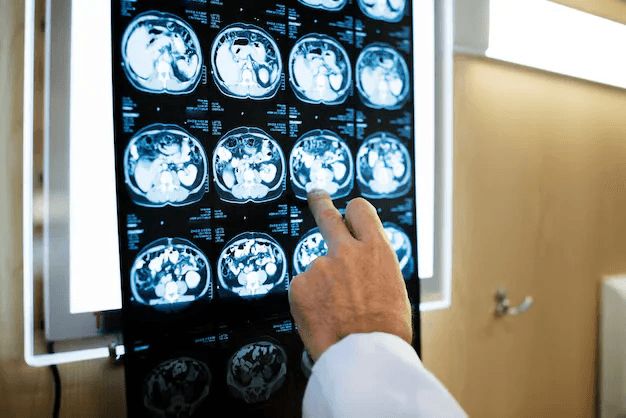 Neurology Revenue Cycle Management